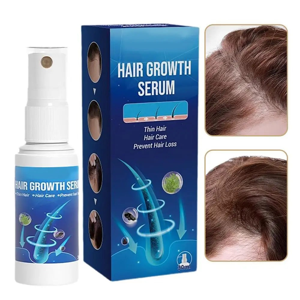 Power Spray - Unlocks Hair Growth