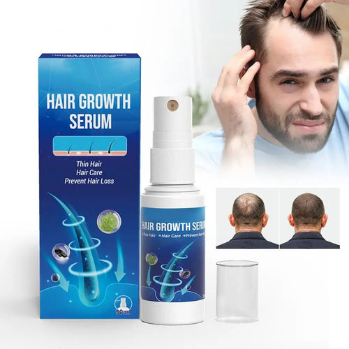 Power Spray - Unlocks Hair Growth