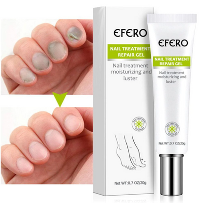 Efero: Contra hongos y micosis en las uñas