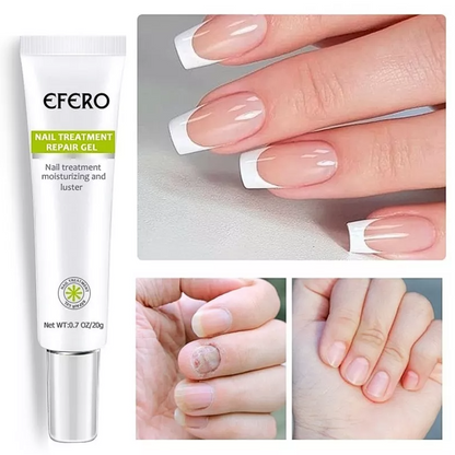 Efero: Contra hongos y micosis en las uñas