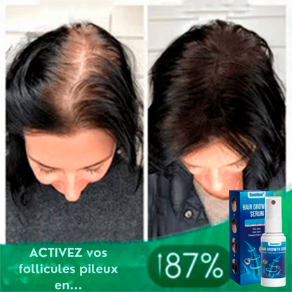 Power Spray - Unlocks Hair Growth
