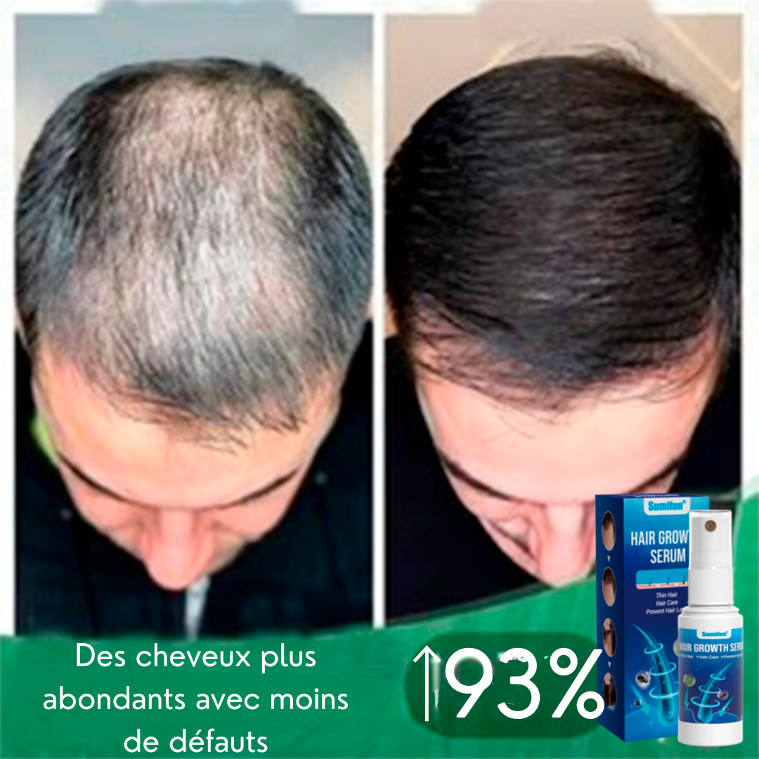 Power Spray - Unlocks Hair Growth