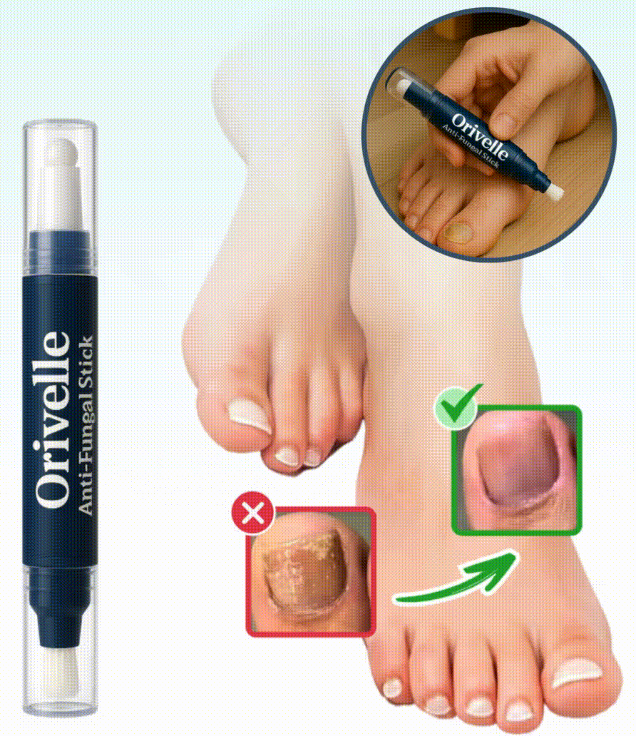 Orivelle - Antifungal Nail Pen