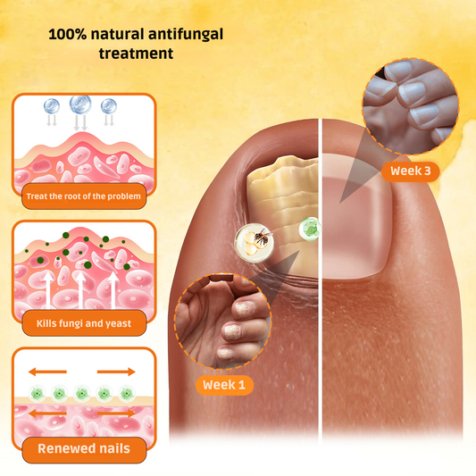 HongoFree: Against fungal and nail infections